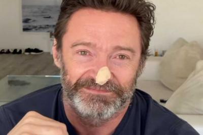 Hugh Jackman revela resultado das biópsias de câncer de pele.